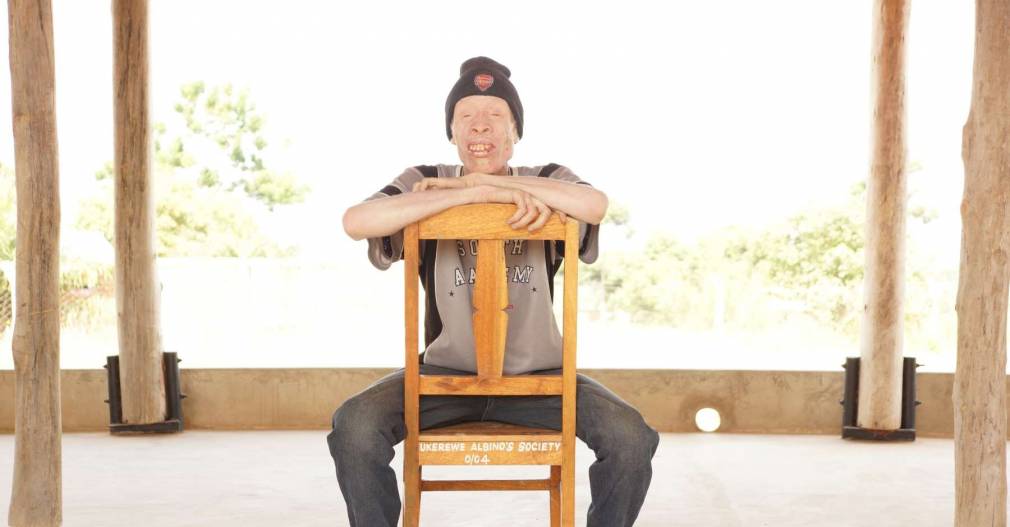 Albinos de Tanzanie : la musique, « envers et contre tout »